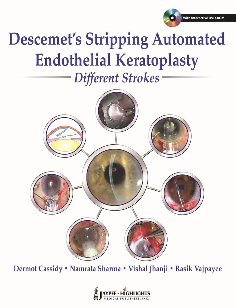 Dermot Cassidy, Namrata Sharma, Vishal Jhanji, Rasik B Vajpayee - Descemet's Stripping Automated Endothelial Keratoplasty: Different Strokes, Inbunden