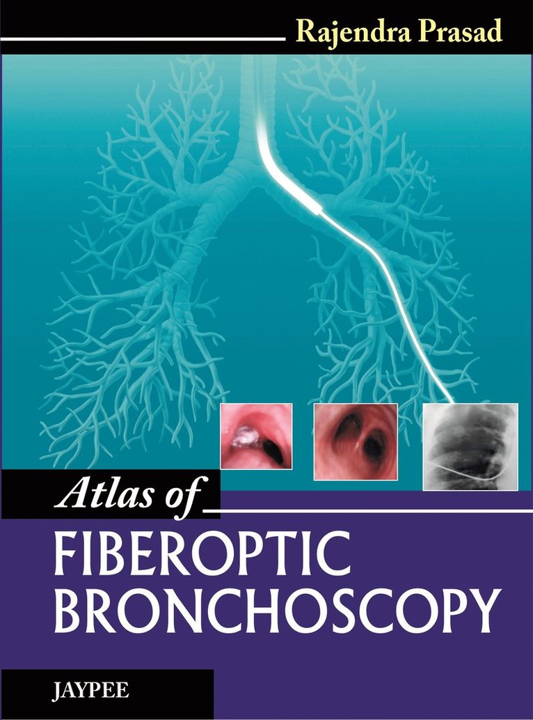 Rajendra Prasad - Atlas of Fiberoptic Bronchoscopy, Inbunden