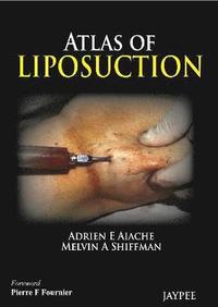 bokomslag Atlas of Liposuction