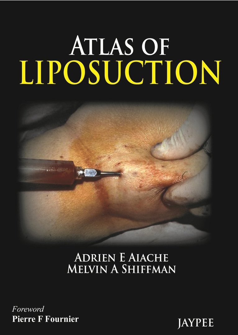 Atlas of Liposuction