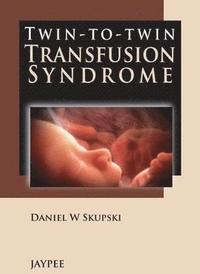 bokomslag Twin-to-Twin Transfusion Syndrome