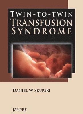 bokomslag Twin-to-Twin Transfusion Syndrome