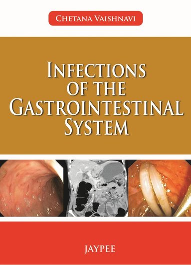 bokomslag Infections of the Gastrointestinal System