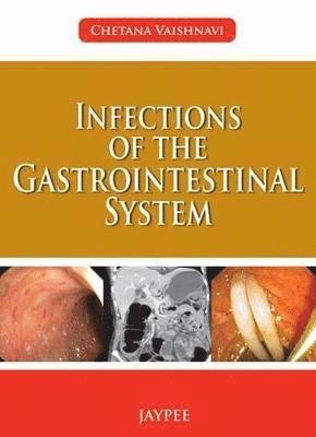 Infections of the Gastrointestinal System 1