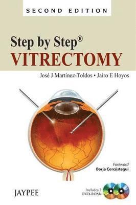 bokomslag Step by Step: Vitrectomy