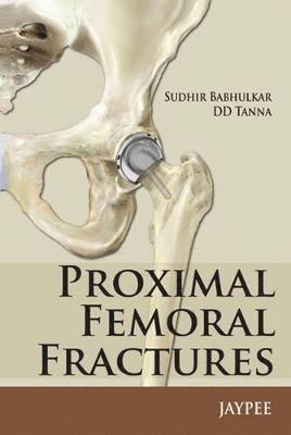 bokomslag Proximal Femoral Fractures