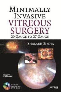 bokomslag Minimally Invasive Vitreous Surgery: 20 Gauge to 27 Gauge