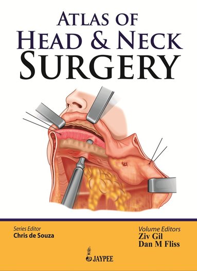 Chris de Souza, Ziv Gil, Dan M Fliss - Atlas of Head & Neck Surgery, Inbunden