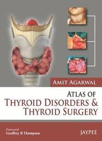 bokomslag Atlas of Thyroid Disorders and Thyroid Surgery