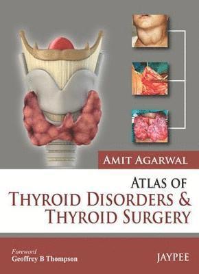 Amit Agarwal - Atlas of Thyroid Disorders and Thyroid Surgery, Inbunden