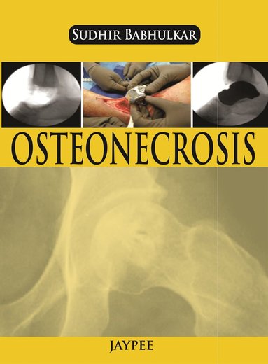 bokomslag Osteonecrosis