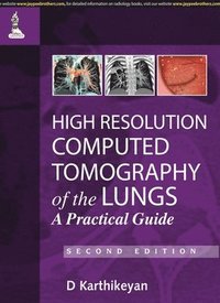 bokomslag High Resolution Computed Tomography of the Lungs: A Practical Guide
