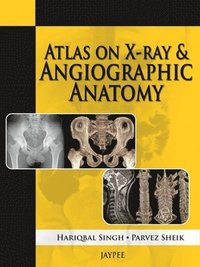 bokomslag Atlas on X-Ray and Angiographic Anatomy