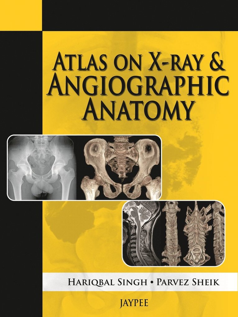 Atlas on X-Ray and Angiographic Anatomy 1