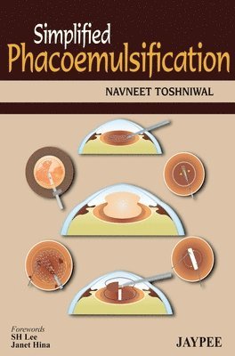 bokomslag Simplified Phacoemulsification