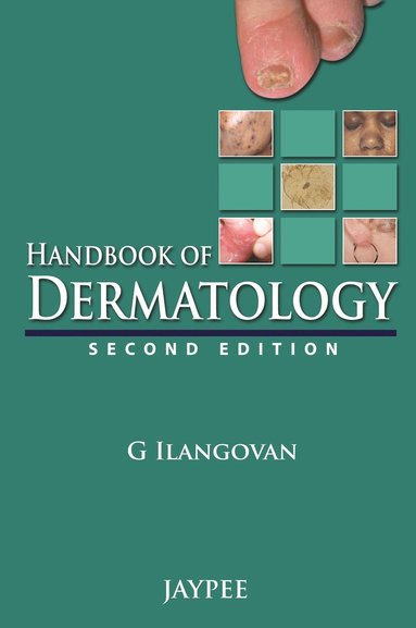 bokomslag Handbook of Dermatology