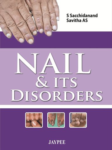 bokomslag Nail & Its Disorders