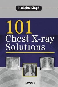 bokomslag 101 Chest X-Ray Solutions