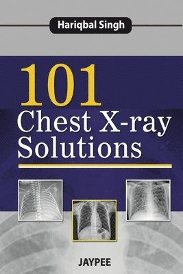 101 Chest X-Ray Solutions 1