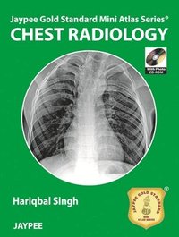 bokomslag Jaypee Gold Standard Mini Atlas Series: Chest Radiology