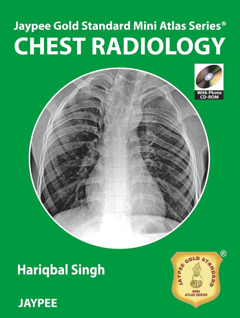 Jaypee Gold Standard Mini Atlas Series: Chest Radiology 1