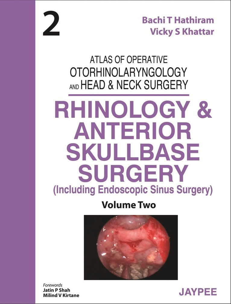 Bachi T Hathiram, Vicky S Khattar - Atlas of Operative Otorhinolaryngology and Head & Neck Surgery: Rhinology and Anterior Skullbase Surgery, Inbunden