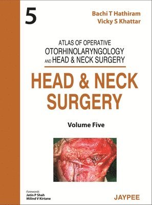 Atlas of Operative Otorhinolaryngology and Head & Neck Surgery: Head and Neck Surgery 1