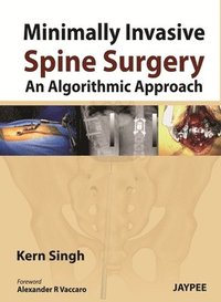 bokomslag Minimally Invasive Spine Surgery: An Algorithmic Approach