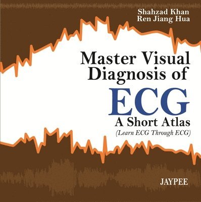 Master Visual Diagnosis of ECG: A Short Atlas (Learn ECG through ECG) 1