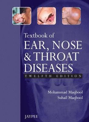 Mohammad Maqbool, Suhail Maqbool - Textbook of Ear, Nose and Throat Diseases, Häftad