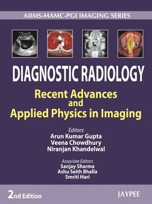 Arun Kumar Gupta, Veena Chowdhury, Niranjan Khandelwal - Diagnostic Radiology: Recent Advances and Applied Physics in Imaging, Inbunden