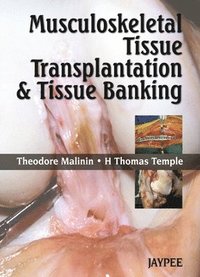 bokomslag Musculoskeletal Tissue Transplantation and Tissue Banking