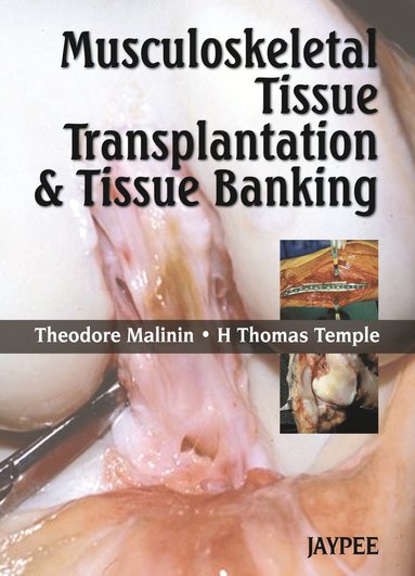 bokomslag Musculoskeletal Tissue Transplantation and Tissue Banking