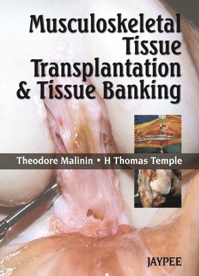 Musculoskeletal Tissue Transplantation and Tissue Banking 1