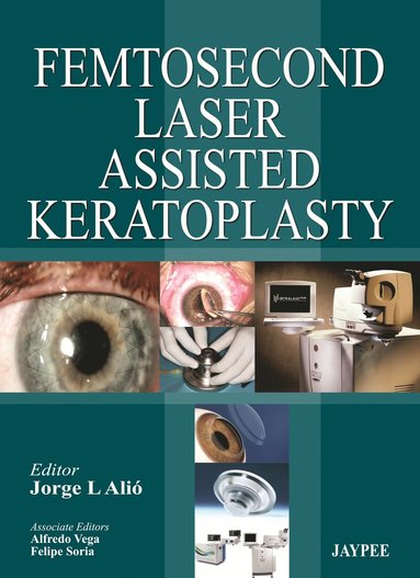 bokomslag Femtosecond Laser Assisted Keratoplasty