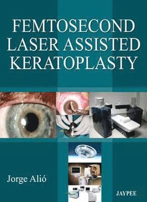 Jorge L Alio - Femtosecond Laser Assisted Keratoplasty, Inbunden