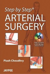 bokomslag Step by Step: Arterial Surgery