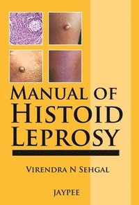 bokomslag Manual of Histoid Leprosy