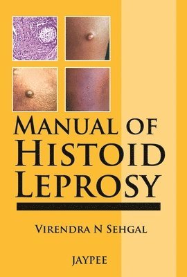 Manual of Histoid Leprosy 1