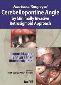 bokomslag Functional Surgery of Cerebellopontine Angle by Minimally Invasive Retrosigmoid Approach