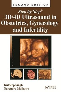 bokomslag Step by Step: 3D/4D Ultrasound in Obstetrics, Gynecology and Infertility