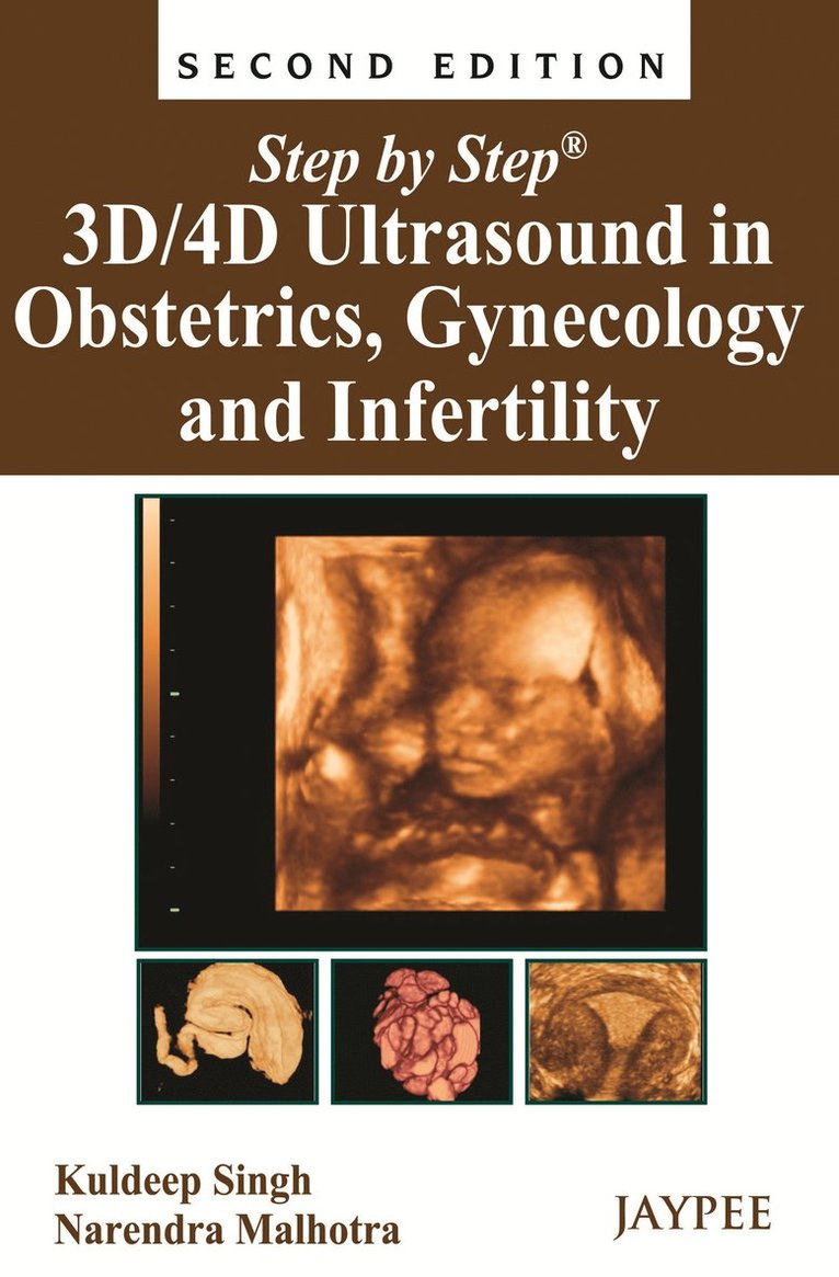 Kuldeep Singh, Narendra Malhotra - Step by Step: 3D/4D Ultrasound in Obstetrics, Gynecology and Infertility, Häftad