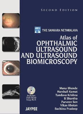 Atlas of Ophthalmic Ultrasound and Ultrasound Biomicroscopy 1
