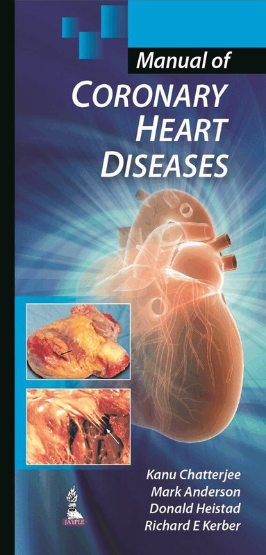 Kanu Chatterjee, Mark Anderson, Donald Heistad, Richard E Kerber - Manual of Coronary Heart Diseases, Häftad