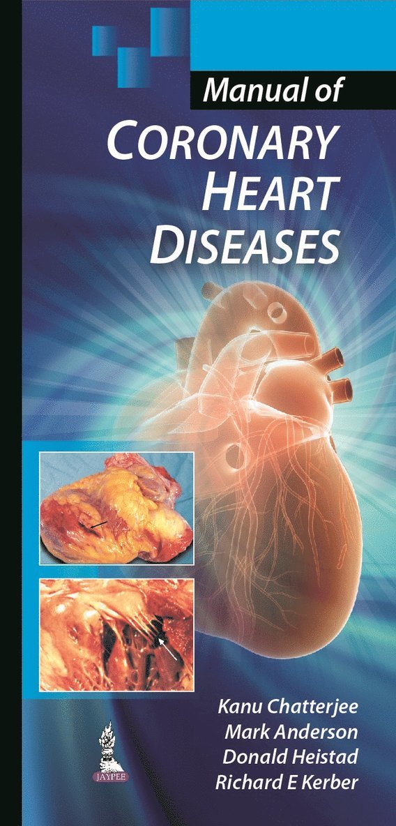 Kanu Chatterjee, Mark Anderson, Donald Heistad, Richard E Kerber - Manual of Coronary Heart Diseases, Häftad