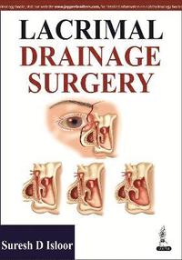 bokomslag Lacrimal Drainage Surgery