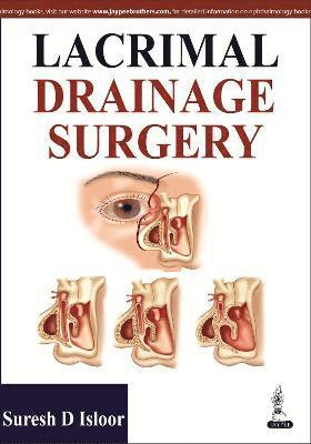 Lacrimal Drainage Surgery 1