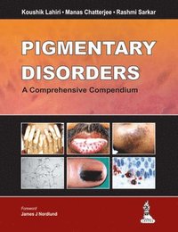 bokomslag Pigmentary Disorders