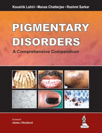 Koushik Lahiri, Manas Chatterjee, Rashmi Sarkar - Pigmentary Disorders, Inbunden