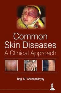 bokomslag Common Skin Diseases